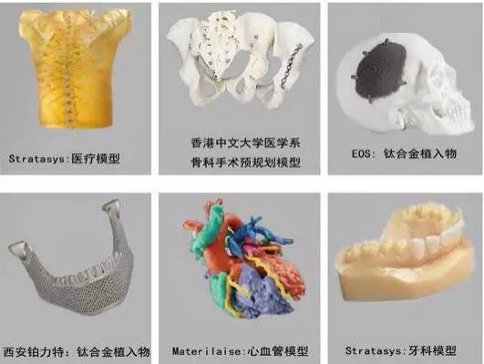 3d打印在医疗领域的应用 3D打印与医疗行业白皮书