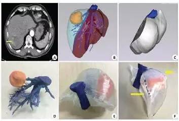 3d打印在医疗领域的应用 3D打印与医疗行业白皮书