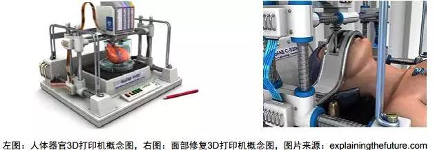 3d打印在医疗领域的应用 3D打印与医疗行业白皮书