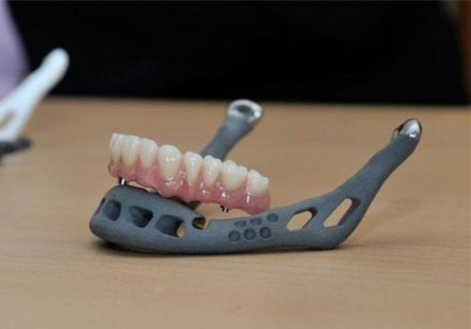 医疗3D打印的假牙 新手选择3D打印手板模型加工打样还是CNC加工?选择当地还是全国3D打印公司?