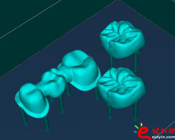 3d打印牙齿价格,3d打印牙齿模型,3d打印牙齿临床了吗,3d打印牙齿价格表,3d打印牙齿能用多久
