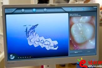3d打印牙齿价格,3d打印牙齿模型,3d打印牙齿临床了吗,3d打印牙齿价格表,3d打印牙齿能用多久