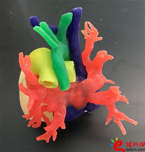 3D打印血管