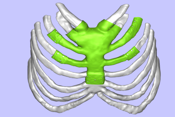 医疗行业应用3d打印技术的优点与缺点