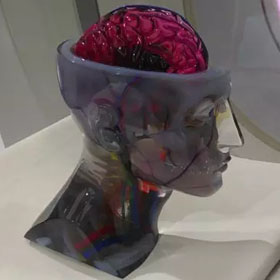 彩色3d打印人体器官医学模型4