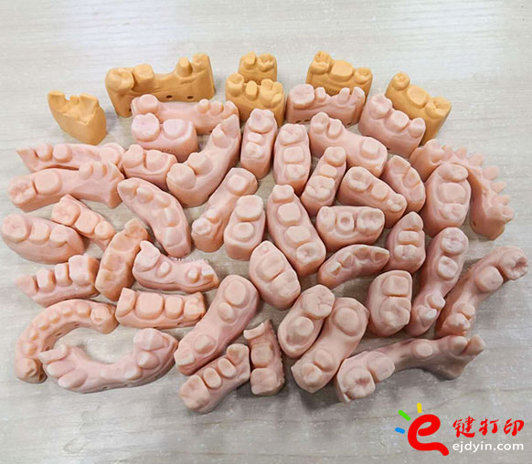 3D打印牙模