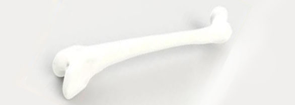 股骨金属植入物2