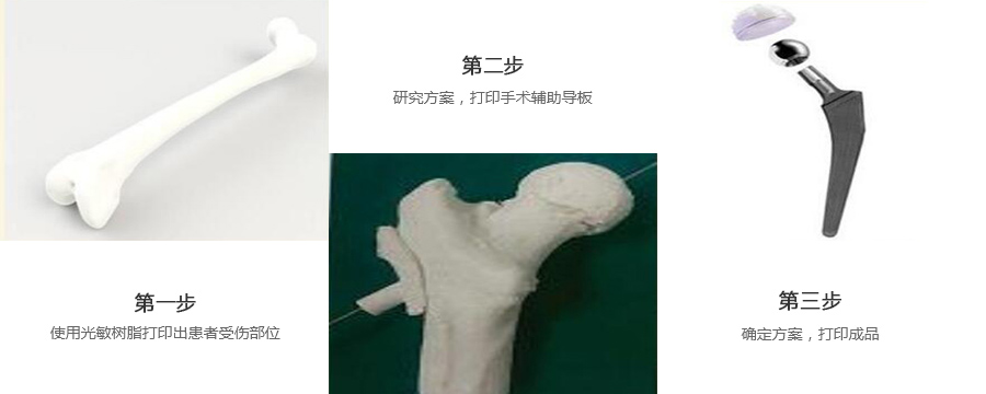 股骨金属植入物制作流程
