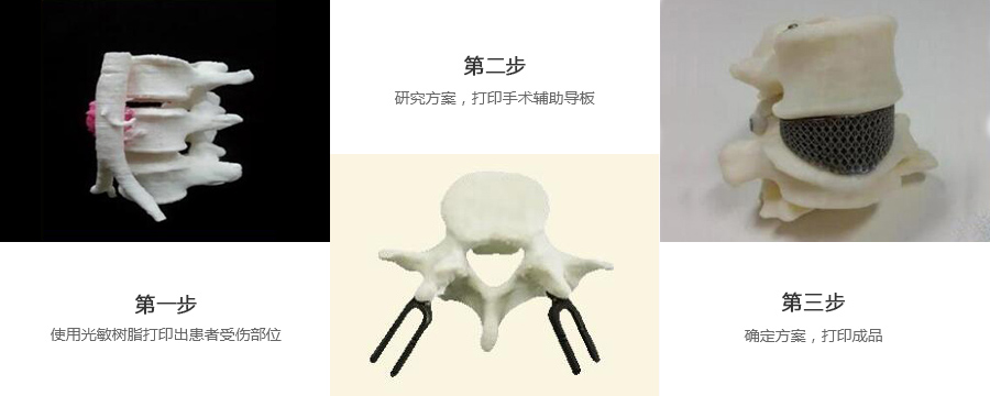 腰椎金属植入物制作流程