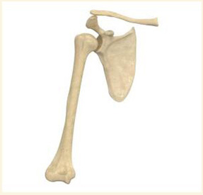 肩关节金属植入物3